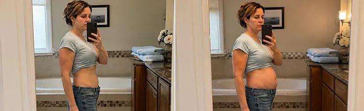 Same woman, same outfit: flat stomach at 7 AM versus visibly distended at 7 PM